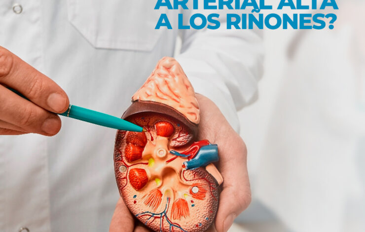 ¿Cómo daña la presión arterial alta los riñones?